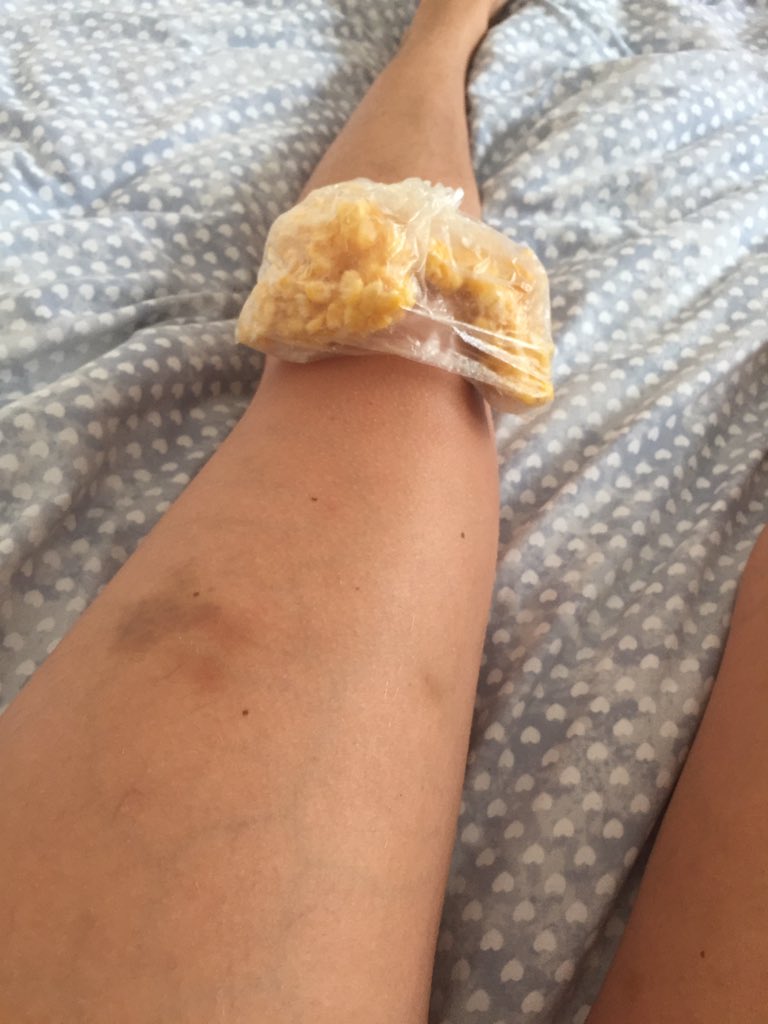troublegal44's tweet photo. Meant to be in the gym but bashed my knee so hard it hurts to bend 😩 https://t.co/414io8ul8T