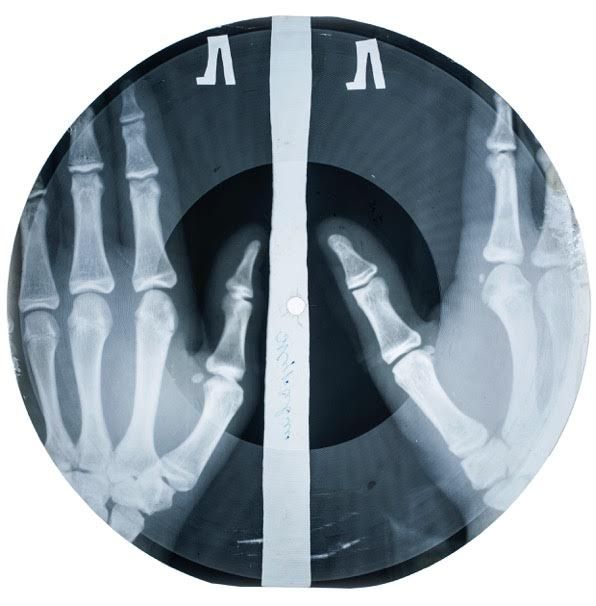 Pushkin_House's tweet photo. THE STRANGE STORY OF SOVIET MUSIC ON THE BONE https://t.co/5eLhyJCZGo https://t.co/C3uWj5ycfh