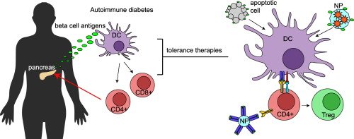 Dr_ASingh's tweet image. #ImmuneEngineering (6/23):Phelps/Baekkeskov/Hubbell &quot;BioE strategies for inducing tolerance in #autoimmune diabetes&quot; sciencedirect.com/science/articl…