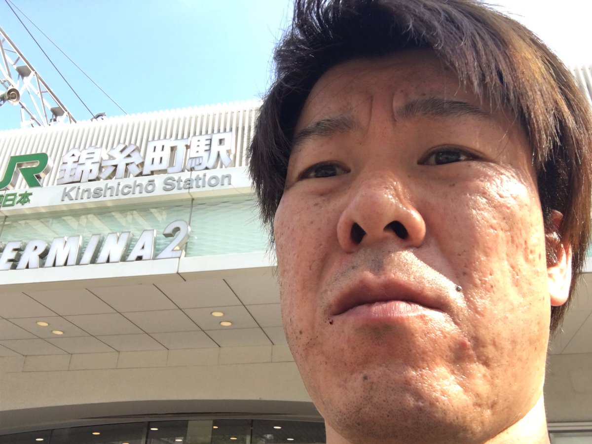 金 バエ 肌
