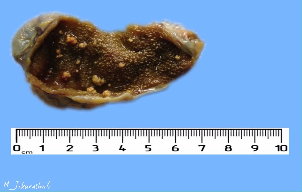 Manana Jikurashvili tweet media