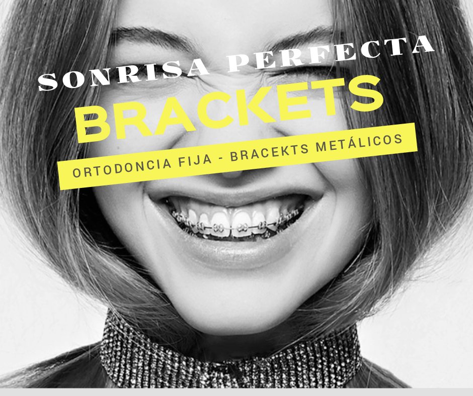 DMISmileDesign's tweet photo. BRACKETS METÁLICOS CON 50% DSCTO. EN CUOTA INICIAL!!! CAMPAÑA DE ORTODONCIA FIJA SÓLO POR LOS MESES DE JUNIO Y JULIO. https://t.co/FxPKZyigCb