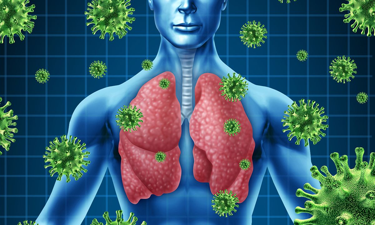 ASIDANZ's tweet photo. Antibiotics prescribed at 4-9 times recommended rates for ARIs by Aus GPs #AMR17 https://t.co/rbcS0MbUrJ https://t.co/JpoBKklEuj
