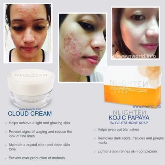joyli2wayco's tweet photo. Effective,fast result no harm,no damages to your skin. All naturals and skin care products.Satisfaction guaranteed! https://t.co/WoAwo7MEuV