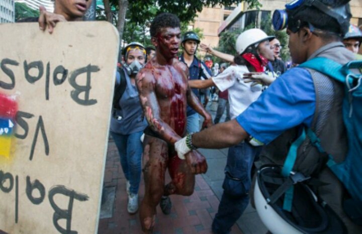 damorenoVzla's tweet photo. Éstas imágenes nunca las olvidaré.
Golpeado y quemado vivo.
Es la verdadera política de los terroristas salvajes que quieren gobernar Vzla. https://t.co/xEAT0TFvTC