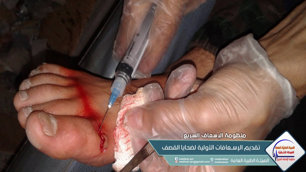 مازالت الحملة العسكرية الوحشية مستمرة على بلدات #الغوطة_الشرقية, يستخدم بها نظام الأسد شتى أنواع الأسلحة الفتاكة على منازل المدنيين يومياً.