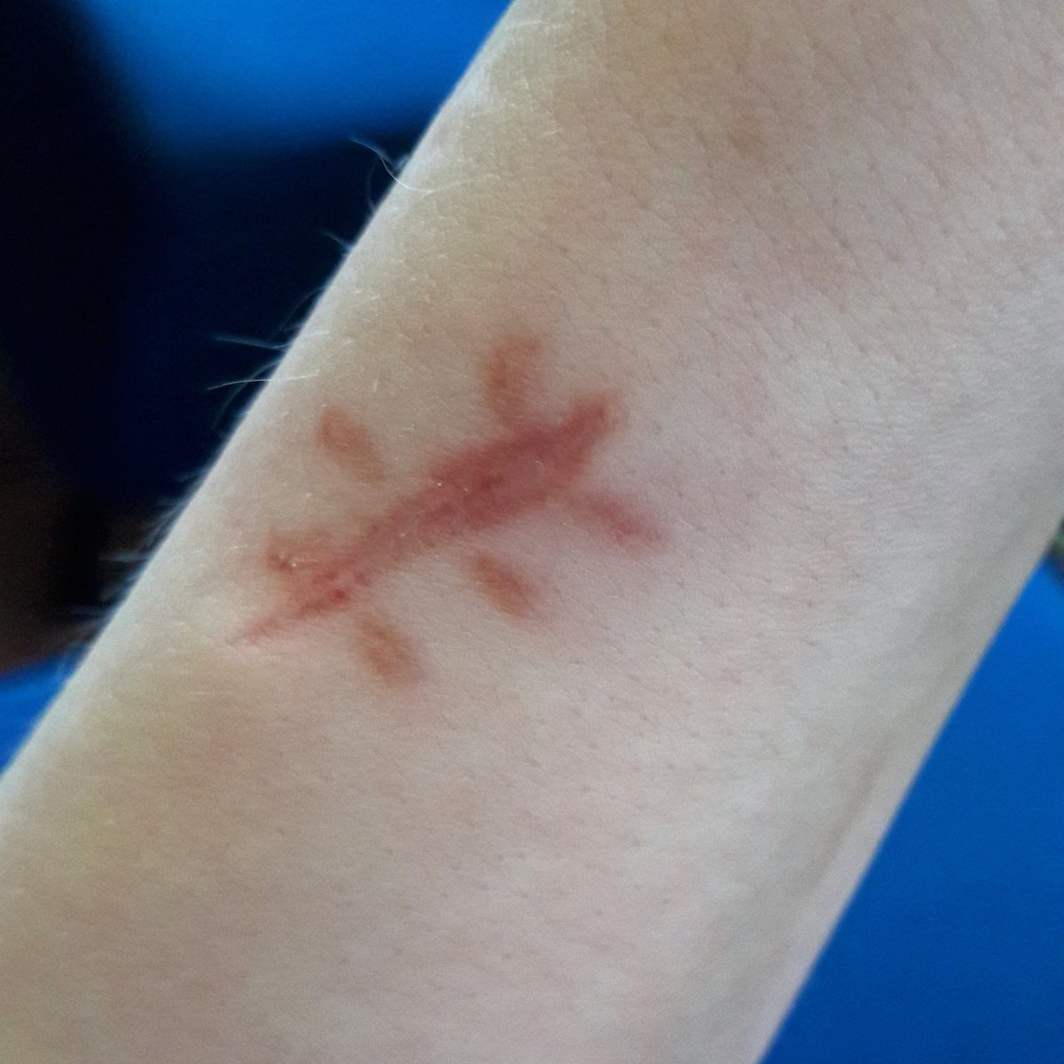 AuthorFredrika's tweet photo. And this, children, is the result of fighting an alien bug. Don't do this alone and untrained! #Alidn #Alienbug https://t.co/2A4uv2lXg2