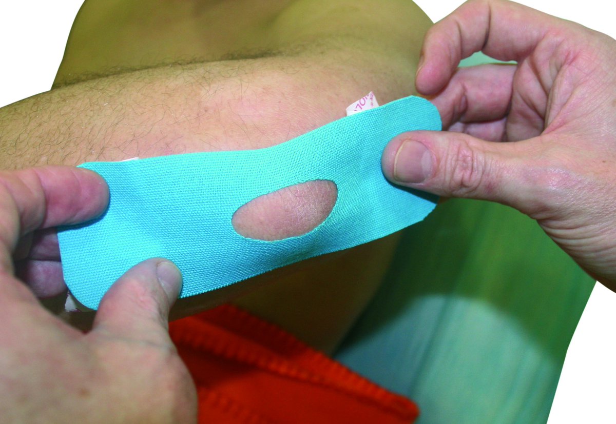 Temtex_Es's tweet photo. Nueva técnica de #VendajeNeuromuscular para aliviar el dolor de la Bursitis Olecraniana #Temtex https://t.co/q5f86gXZpZ https://t.co/U11Bkzk3bH