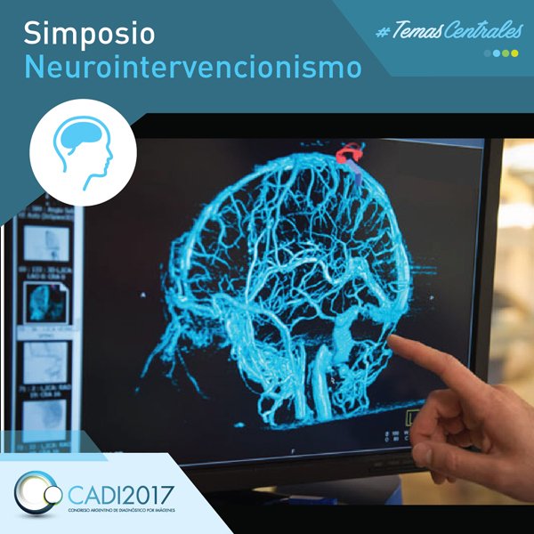 ☢️#TemasCentrales 👉Hoy te presentamos: #Simposio #Neurointervencionismo Sábado 16/9 +temas en cadi2017.com.ar/programa.html #Radiología #radiology