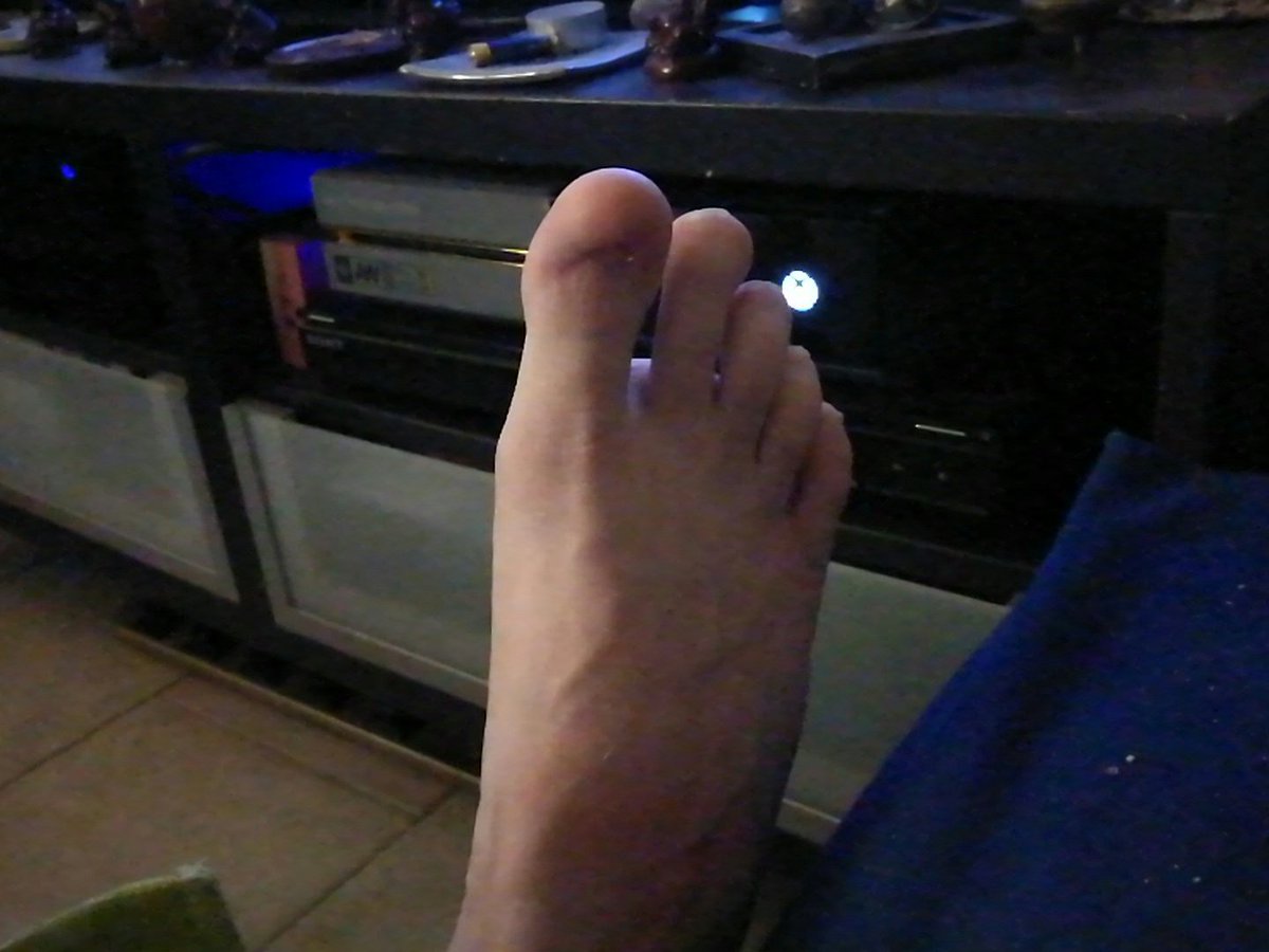 RipperBen's tweet image. #tpmp y a qu un pied mais il faut regarder le gros doigt de pied