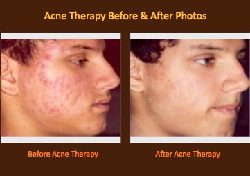 culturacosmetic's tweet photo. TOP ACNE TREATMENT IN @washingtondc | CULTURA https://t.co/4E9wEg7TIC #Skincare #Dermatology #Acne #AcneTreatment #AcneTherapy #Beauty https://t.co/kUBYDU9xDp