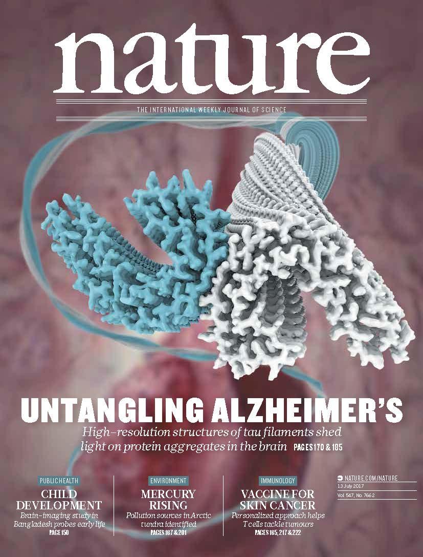 NaturePortfolio's tweet photo. Untangling Alzheimer's. High-resolution structures of tau filaments shed light on protein aggregates in the brain https://t.co/1l8m25PLZQ https://t.co/330AdrRTfz