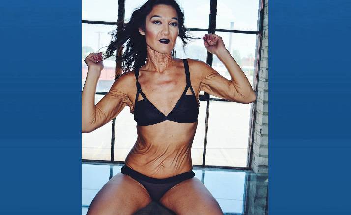 makeupsvanity's tweet image. 26-year-old with rare skin condition challenges beauty standards through modelling - National | Globalnews.ca crwd.fr/2sT0ijE