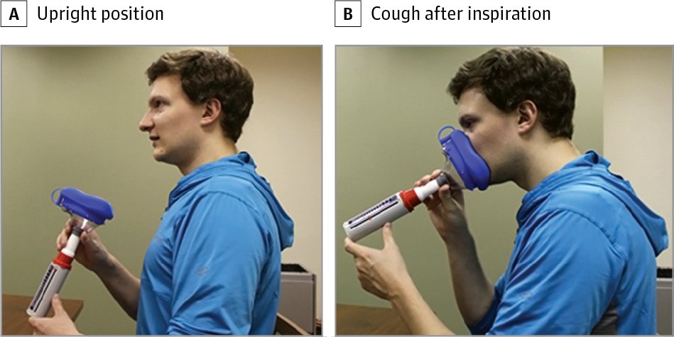 Peak Airflow Measurement in Patients With Glottic Insufficiency After Vocal Fold Augmentation ja.ma/2sULBsc