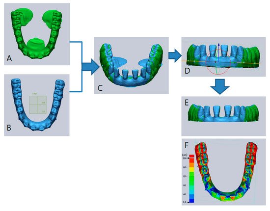 Applsci's tweet photo. Analysis on the Accuracy of #IntraoralScanners: The Effects of Mandibular Anterior #InterdentalSpace https://t.co/tpL1I7XOHB https://t.co/7iokZCojwZ
