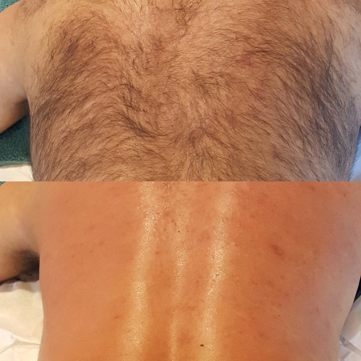 Tranquilstate's tweet photo. Sylvester of Tranquilstate does men's waxing. See before &amp; after images of a full back &amp; shoulder wax. #malewaxing  #hairremoval #skincare https://t.co/fX3GPkGgfl