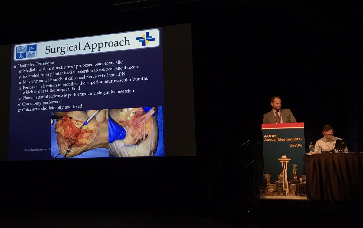 AlexisEDixonMD's tweet photo. Current Brodsky fellow David Jaffe discussing medial approach to calc slide osteotomy in cavovarus reconstruction #AOFAS2017 https://t.co/SAikyfiXVJ