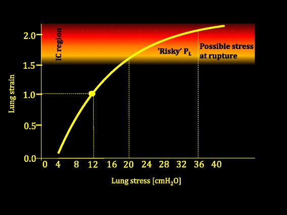 The future of mechanical ventilation: lessons from present &amp; past <a href="/gattinon/">Luciano Gattinoni</a> #ARDS #ECMO #FOAMed #FOAMcc <a href="/Crit_Care/">Critical Care</a> ccforum.biomedcentral.com/articles/10.11…