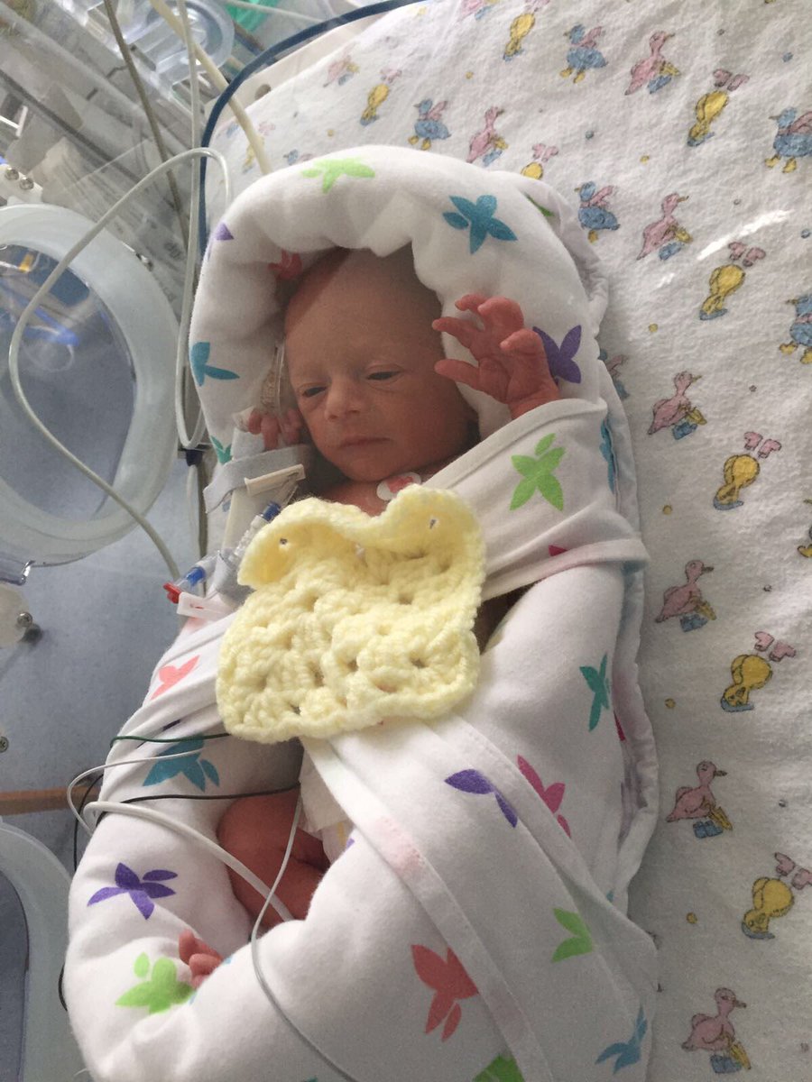 andykphillips's tweet image. And then bump arrives... nearly 6 weeks early but is doing great. #inlove 😍❤️