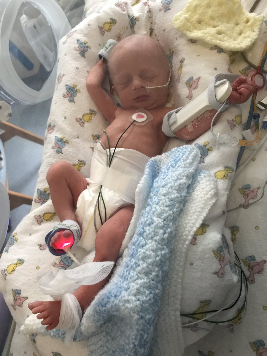 andykphillips's tweet image. And then bump arrives... nearly 6 weeks early but is doing great. #inlove 😍❤️