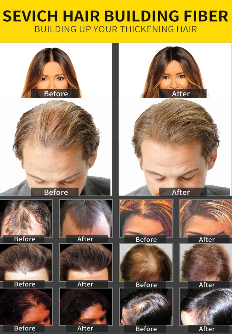 Guangzhou Sanwich Biology Technology Company
sevich.com
whatsapp: +8613620409831
Skype: rita-towne
Email: ritasales@sevich.com