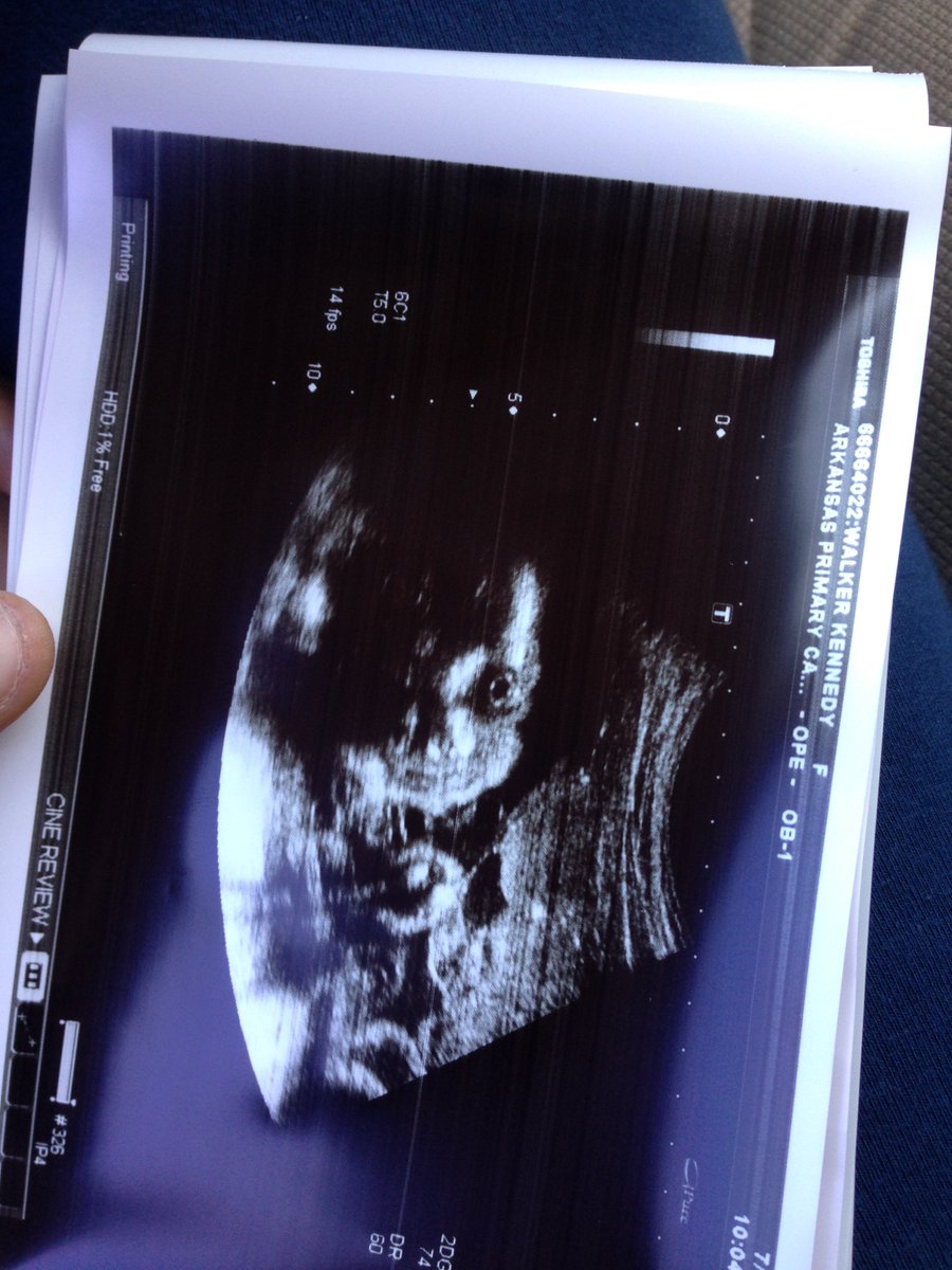 OnlyAllure_'s tweet photo. baby Kynlee Elise Bradley 👣💕 https://t.co/R40owgEIox