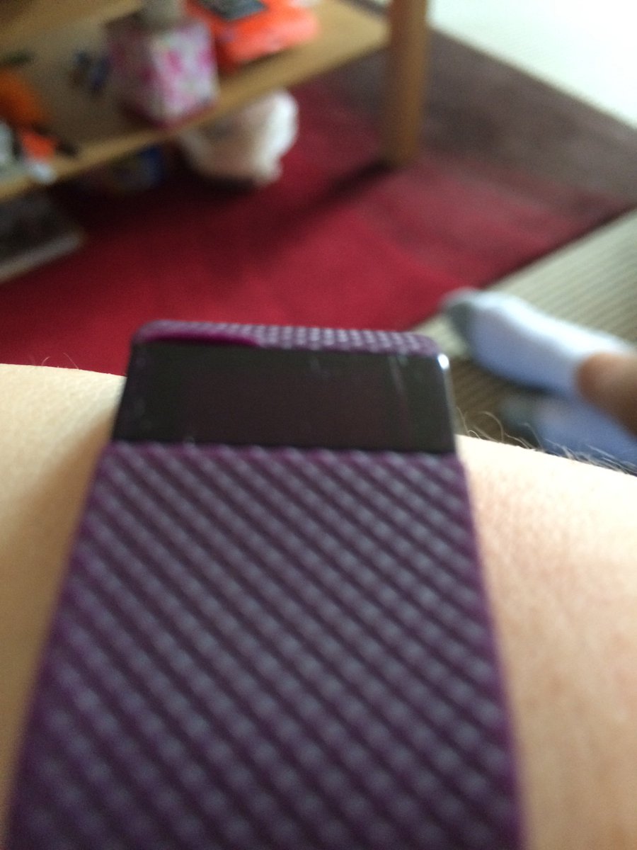 NattyH09's tweet photo. @fitbit what's happening to my Fitbit Charge HR? https://t.co/0sUUNOqTt3