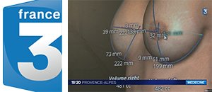 quantificareSA's tweet photo. Thanks @France3tv for having highlighted our #BreastShaper &amp; #beforeafter module at @CongresSofcep #Quantificare #3D https://t.co/mhNdSc8Ont https://t.co/MCQ4yziP2g