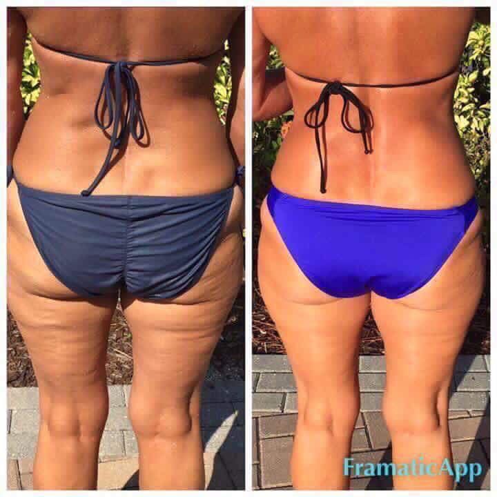 CarenEnderle's tweet photo. Yep....it really works!! #firmitup #takingorders #healthyskin #smoothskin #byebyecellulite https://t.co/lQ37myiOz8