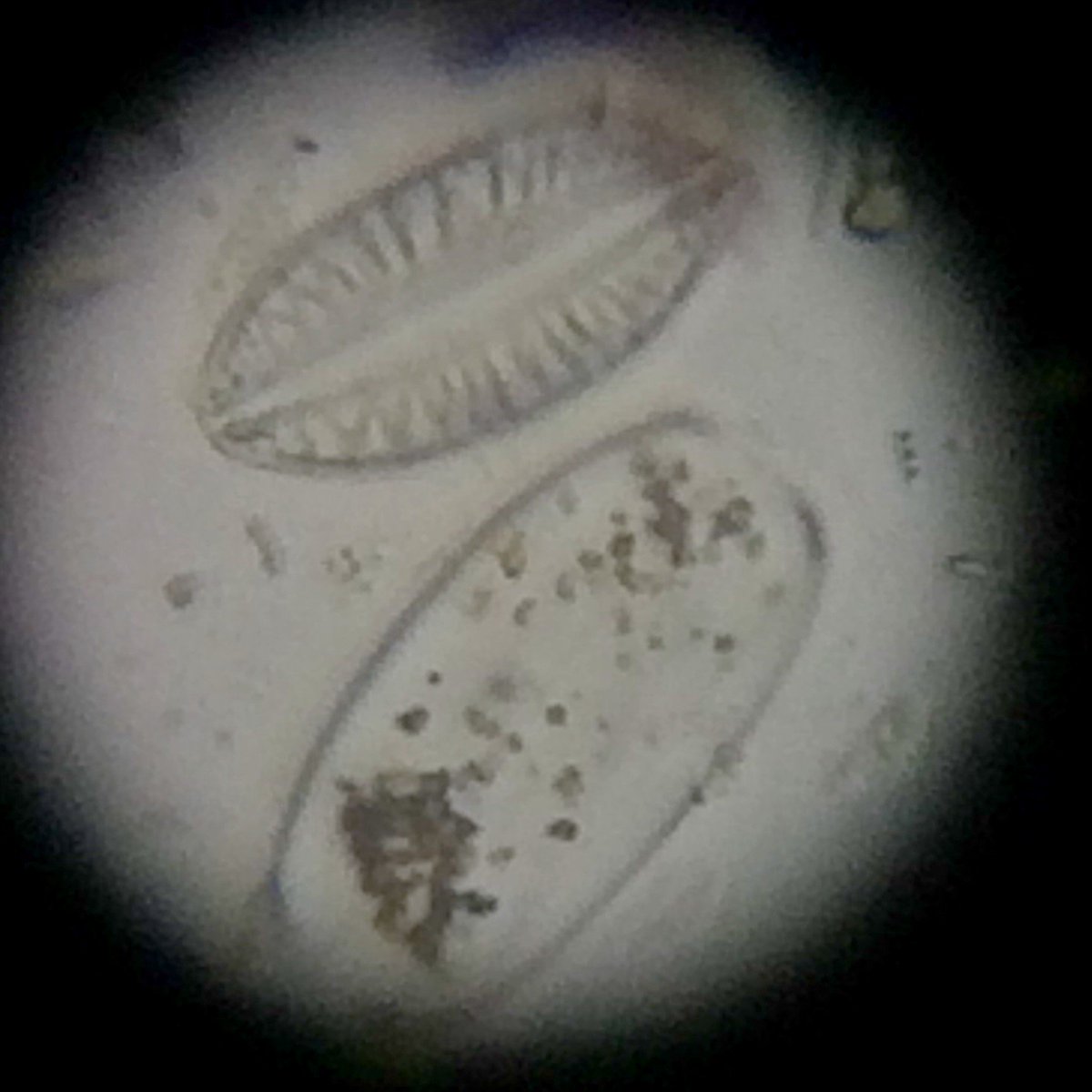 MarineBio_M's tweet photo. While visual results of #Winogradsky columns was not impressive, a window on #microbe #ecology could be seen under the microscope. #TPMarine https://t.co/iWuLjh4DbN