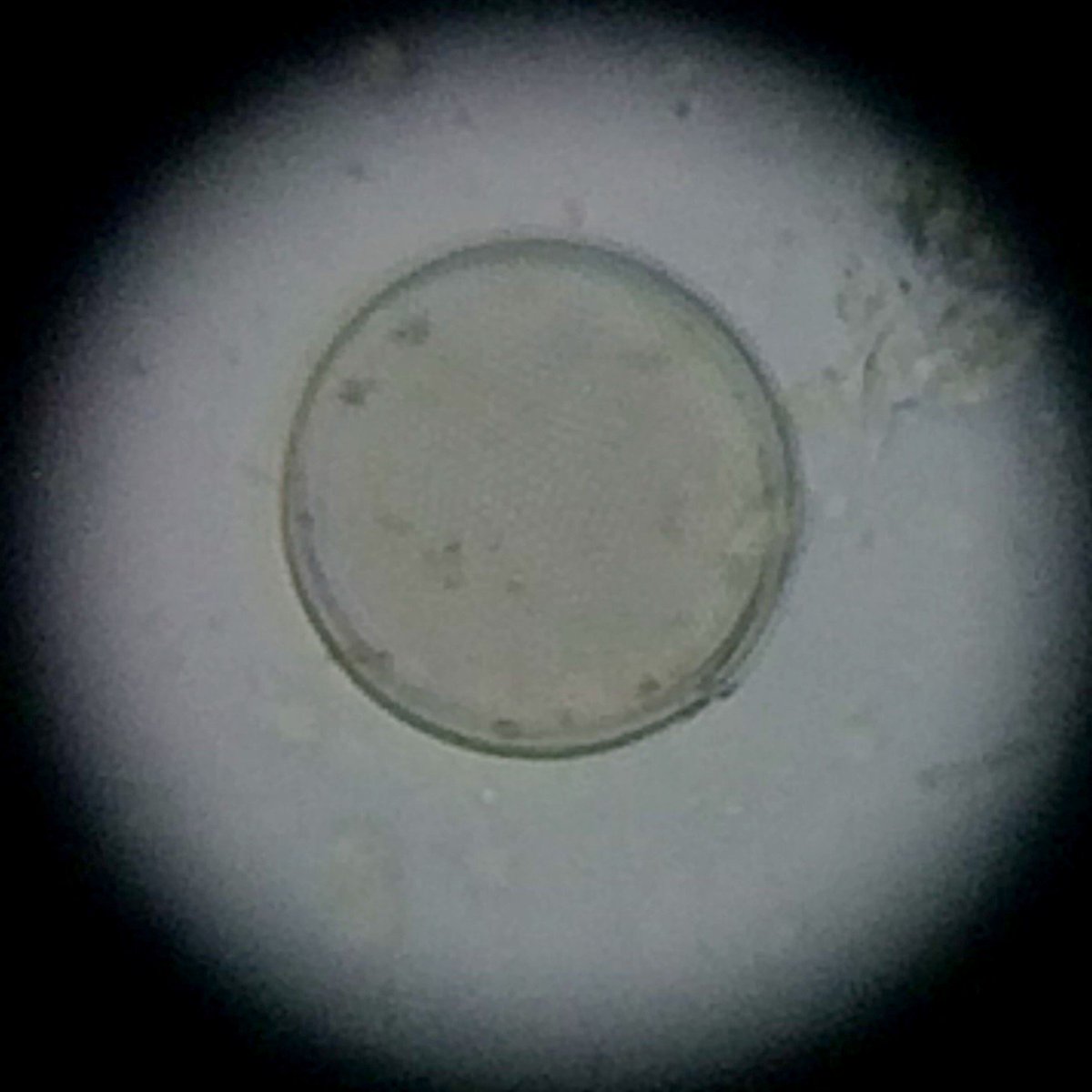 MarineBio_M's tweet photo. While visual results of #Winogradsky columns was not impressive, a window on #microbe #ecology could be seen under the microscope. #TPMarine https://t.co/iWuLjh4DbN