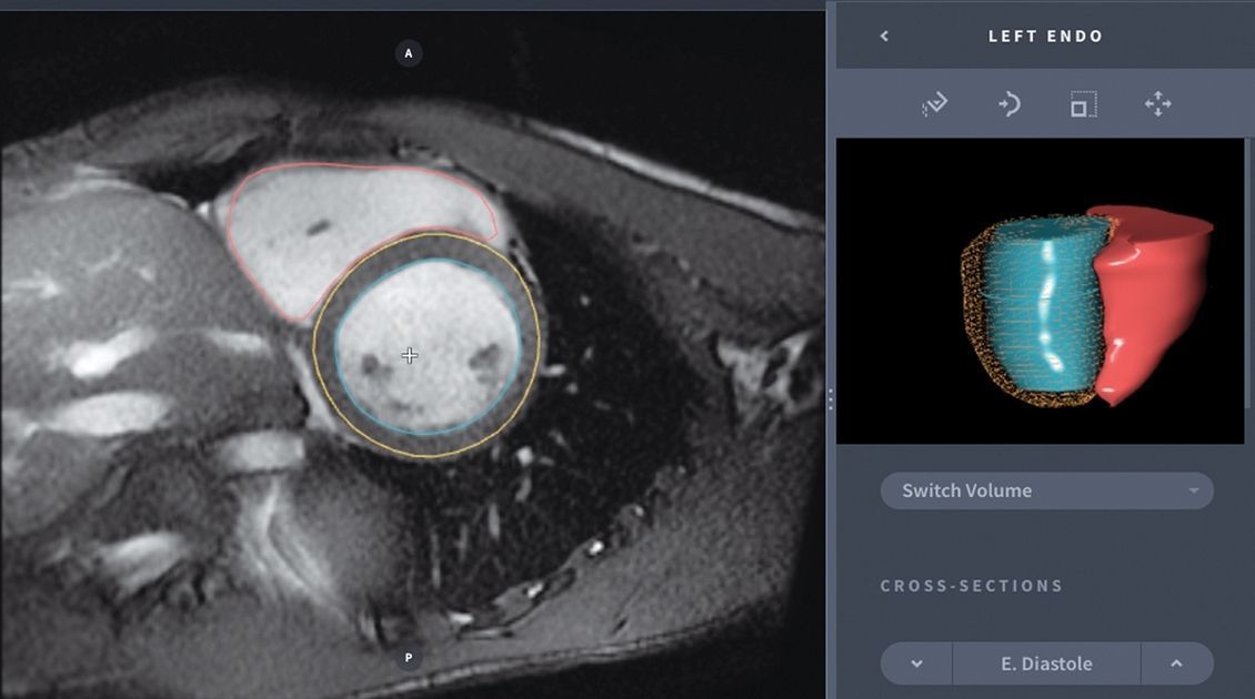 SMART_MD's tweet photo. Artificial intelligence takes on medical imaging https://t.co/COnRVSZVwF via @modrnhealthcr @rachelzarndt #AI #MDNN https://t.co/1AqnPVqHZM