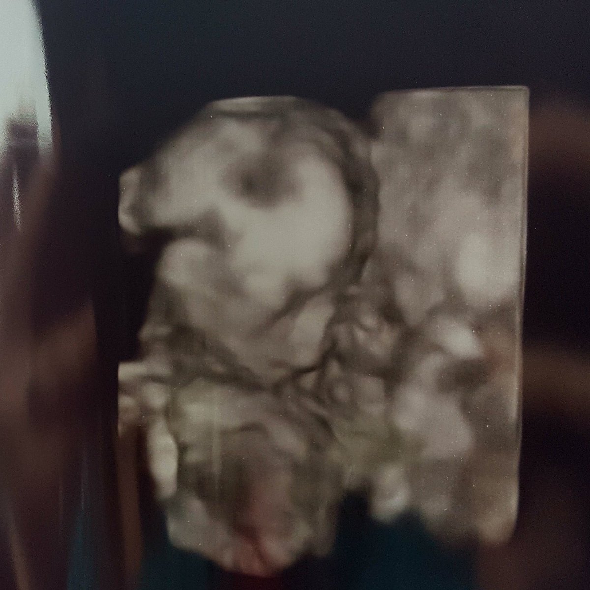 desireescline's tweet photo. Our baby boy is perfect ❤ #18weeks #11oz #151bpm https://t.co/apsqQCWL1L