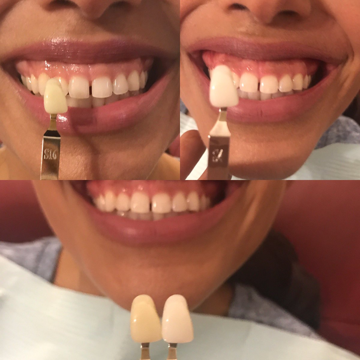 CosmoGlowDFW's tweet photo. A whiter smile can bring a huge boost in confidence. #smilemoreitscontagious #arlingtonspraytan #cosmeticteethwhitening https://t.co/un35tGT489