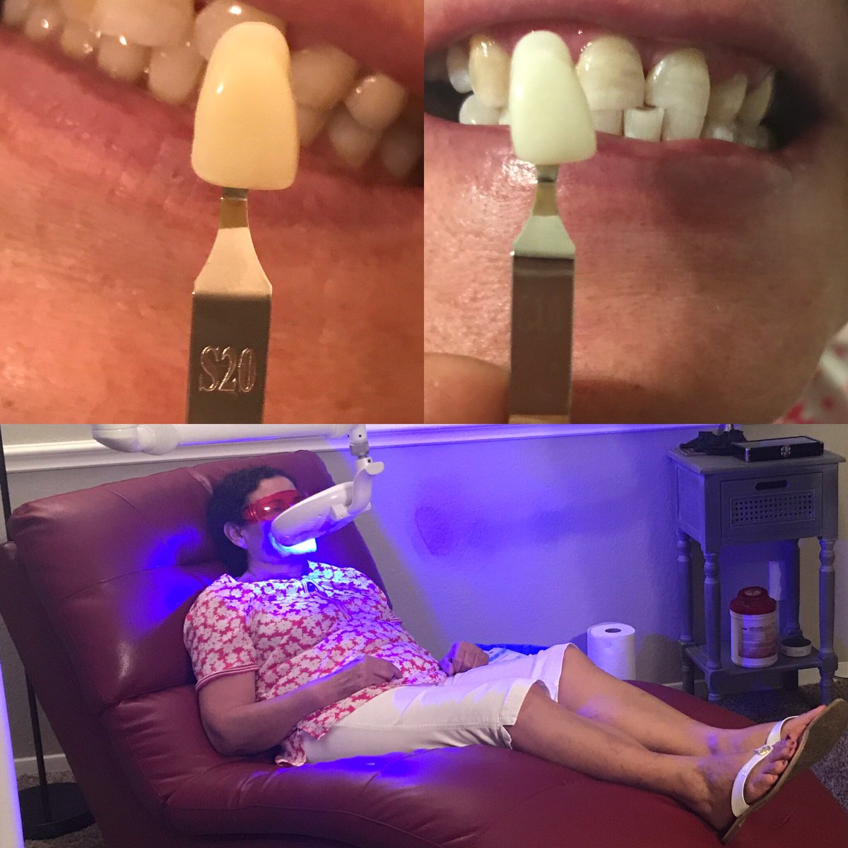 CosmoGlowDFW's tweet photo. Many people have tooth discoloration. Cosmetic Teeth Whitening can correct a lot of those issues and put a smile back on your face. https://t.co/T8y85l2JP7