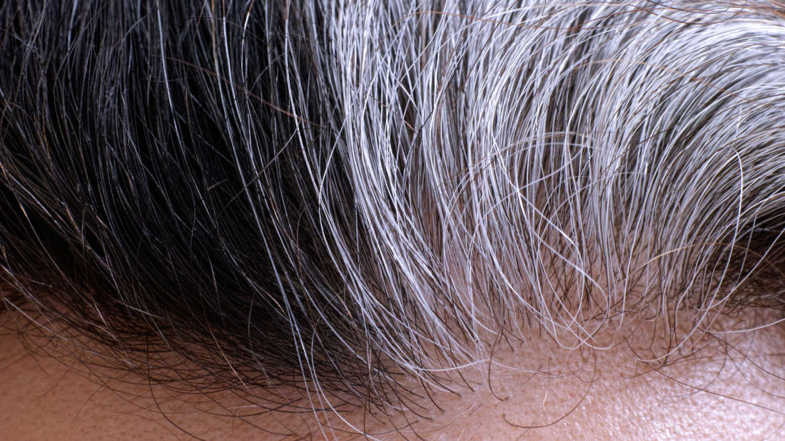 ConnectUsToday's tweet photo. No more greys? Not quite yet.
https://t.co/w5AAcEhWzj https://t.co/fRwFKEpR9v