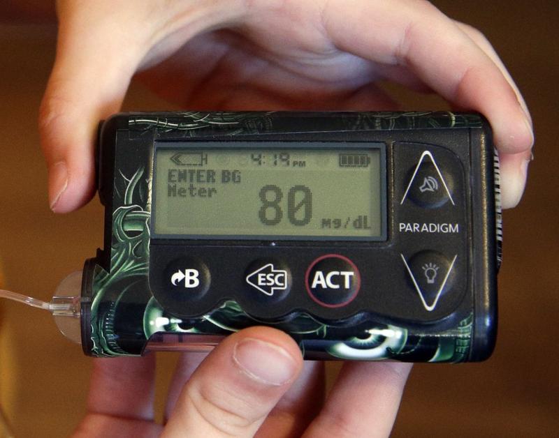 LISTEN: Technology And Advocacy For Patients With Type-1 Diabetes bit.ly/2ha99Ie https://t.co/A0RnmRopBP