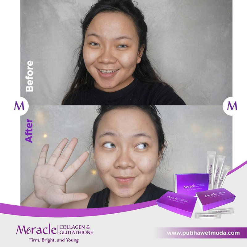 funbizzer's tweet photo. before and after MERACLE 😍😍😍 https://t.co/SUOjsTZUnC