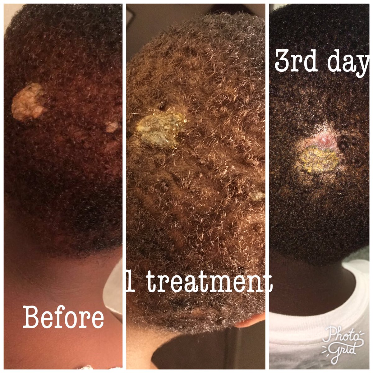 getmended's tweet photo. Think I might become a #dermatologist with an Ayurvedic flair. All natural Good Face products. #Entrepreneur https://t.co/UXS9ECXP54