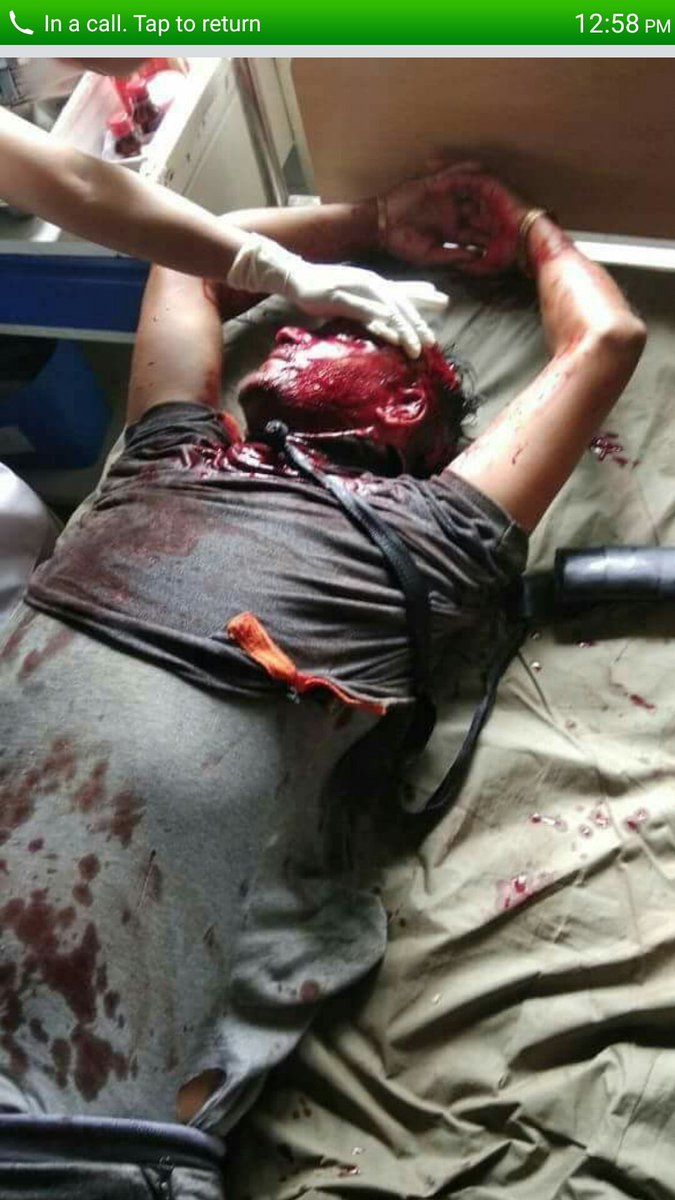 yang_tshering's tweet photo. Peaceful protestors again shot in head near Sukuna #Gorkhaland   @crpfindia @WBPolice . @AskAnshul @HMOIndia @HatindersinghR @Jorebungley https://t.co/45yMG61fqW