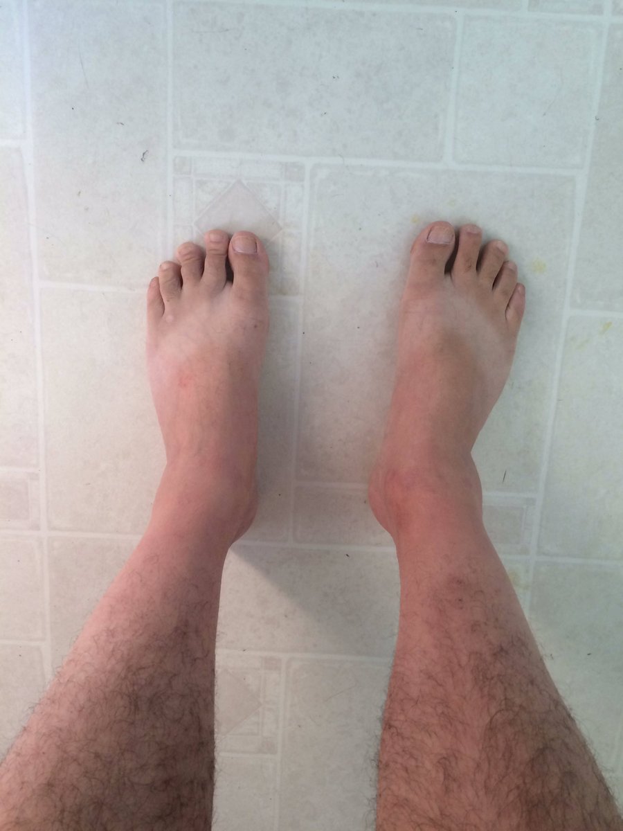 jumpinthebox's tweet photo. Imma work on my flip flop tan so hard today. #suchlegs #muchnice https://t.co/QKbslAL0uM