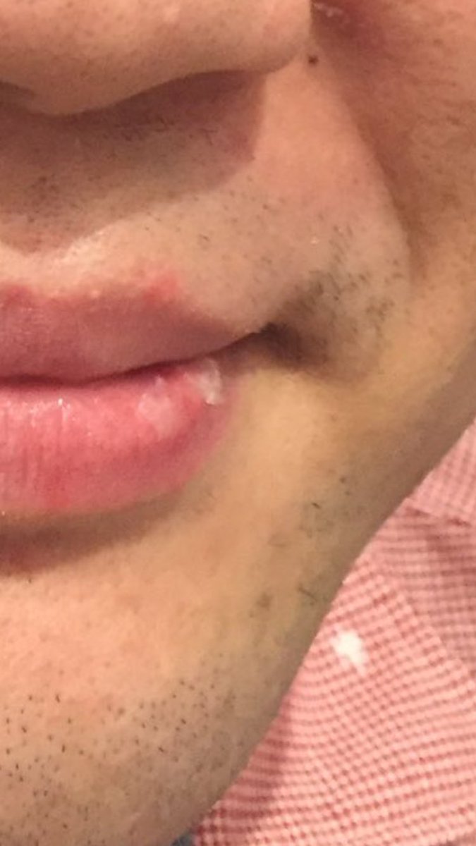 カムカイ 口周りの荒れ