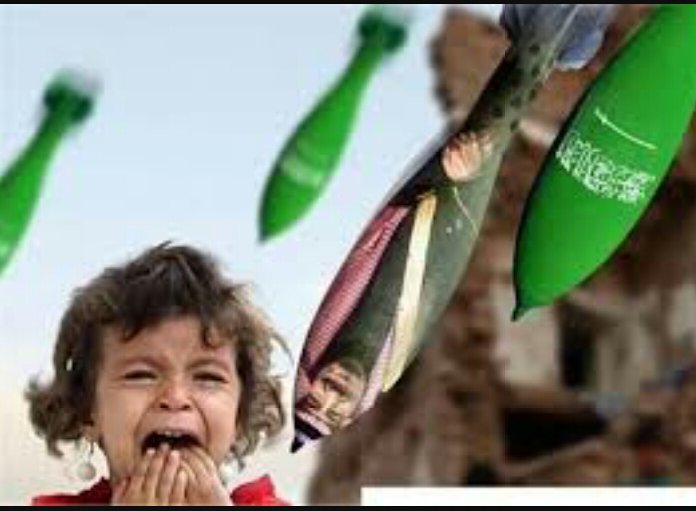 ShomokhYmaniah's tweet photo. #SaudiaArabia rains #Yemen with dozen of missiles everyday, where are #HumanRights and #childrenrights. https://t.co/gsP1loAGpc