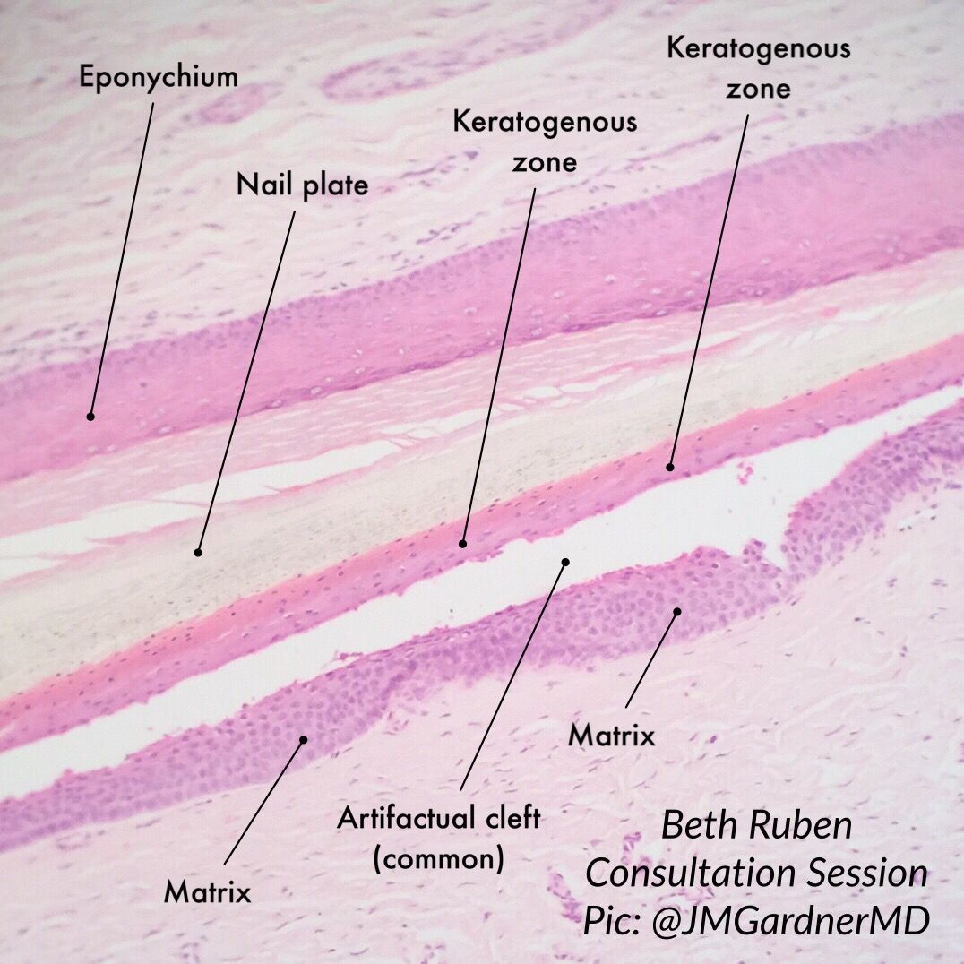 Nail Histology Label