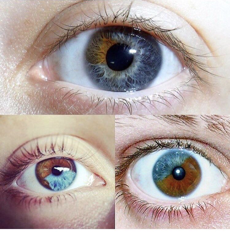 BeautyDiaryNews's tweet image. Heterochromia เป็นยีนที่ผิดปกติชนิดหนึ่งที่ทำให้ดวงตามีสีมากกว่าหนึ่งสีขึ้นไป แต่พบแค่0.5ของประชาชนโลก ดูแปลกตาดีเนอะ
