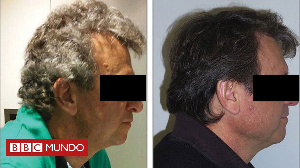 bbcmundo's tweet photo. El tratamiento experimental para el cáncer que le devolvió el color al cabello canoso de los pacientes  https://t.co/fqKPNI0yWb https://t.co/HwMoNo6Yu9