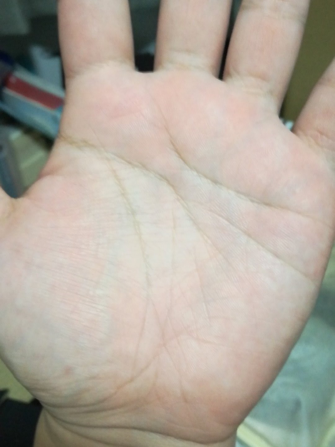 大西哲也 変形ますかけ線 らしい 手相 T Co Koiu9dv6nf Twitter 大西哲也 変形ますかけ線 らしい 手相 T Co Koiu9dv6nf Twitter