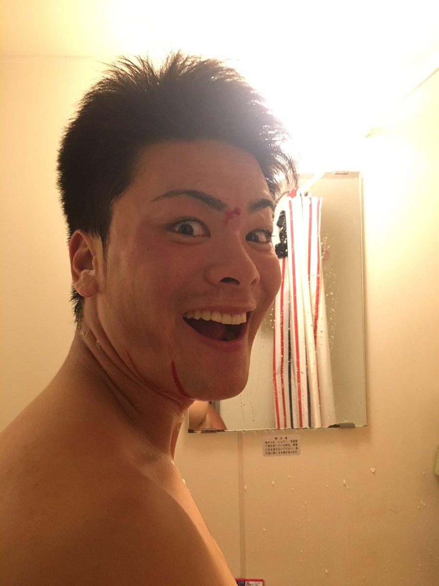 髙橋 剣 En Twitter がめ ひげ剃り失敗して顔血だらけ 髙橋 剣 En Twitter がめ ひげ剃り失敗して顔血だらけ