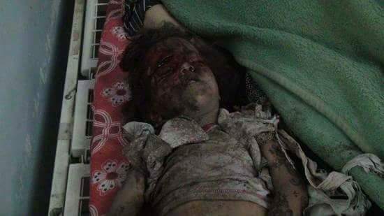 ShomokhYmaniah's tweet photo. When #ChildhoodViolated, all different kinds of oppression happens. #StopIgnoringYemen
#handsOffYemen
#Saudia
#USA
#UN https://t.co/fmtgLj2h9J