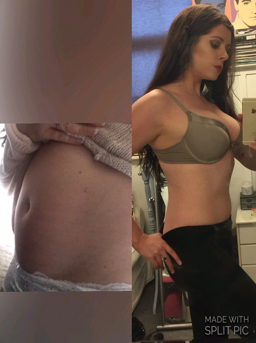 donnarhian31's tweet photo. The image on left is how bloated I was just over 3 weeks ago, &amp; this is how I look today (no editing) after losing 7lbs.#mebeverine #fitness https://t.co/T6jQB8H4tv